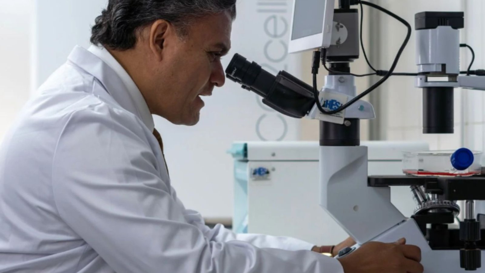 cancer de prostata en peru