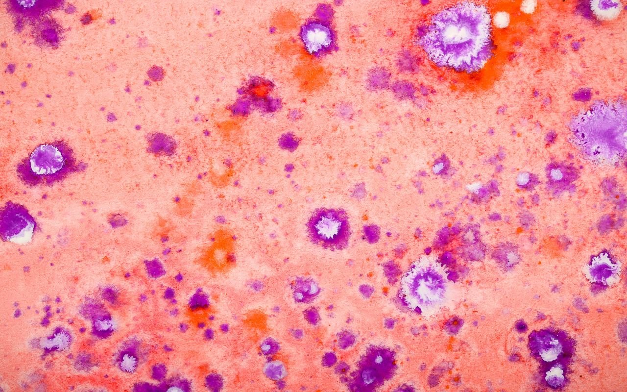 Representación tridimensional de la red celular, el flujo de señales moleculares y la conectividad del sistema inmunológico en pacientes con cáncer avanzado.