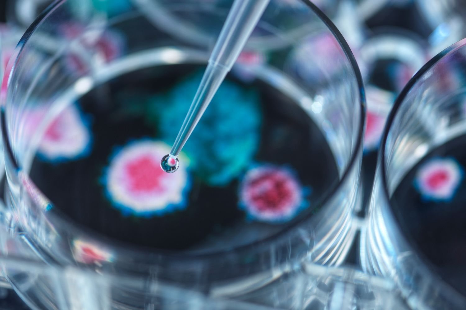 Representación visual de la investigación inmunológica avanzada y la organización funcional del sistema inmune en pacientes con cáncer avanzado.