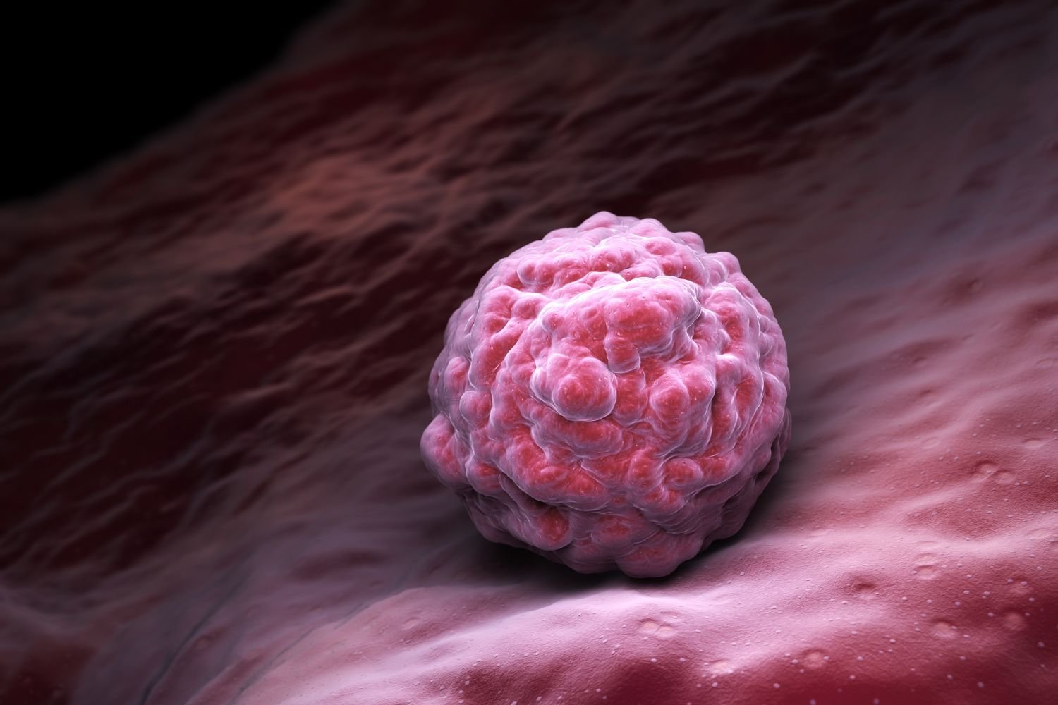 Representación visual de los microdominios celulares y su papel en la organización estructural del sistema inmunológico en cáncer avanzado.